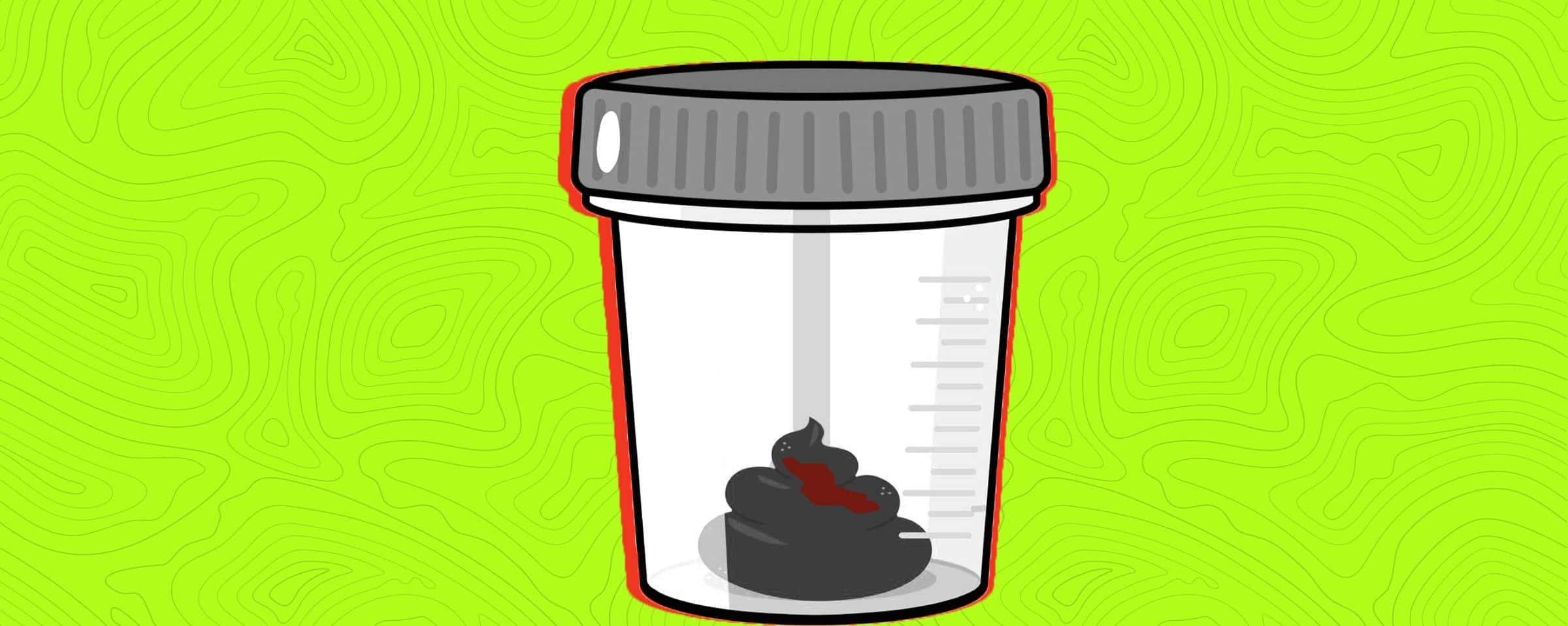 Blood in Stool? 7 Tell-tale Signs of Colorectal Cancer
