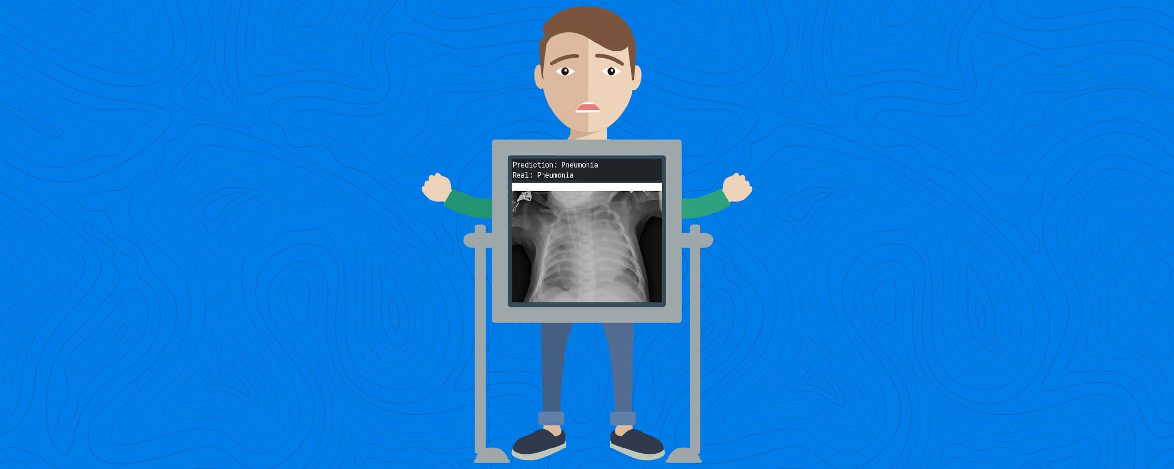 5 Surprising Facts You Didn’t Know About Pneumonia