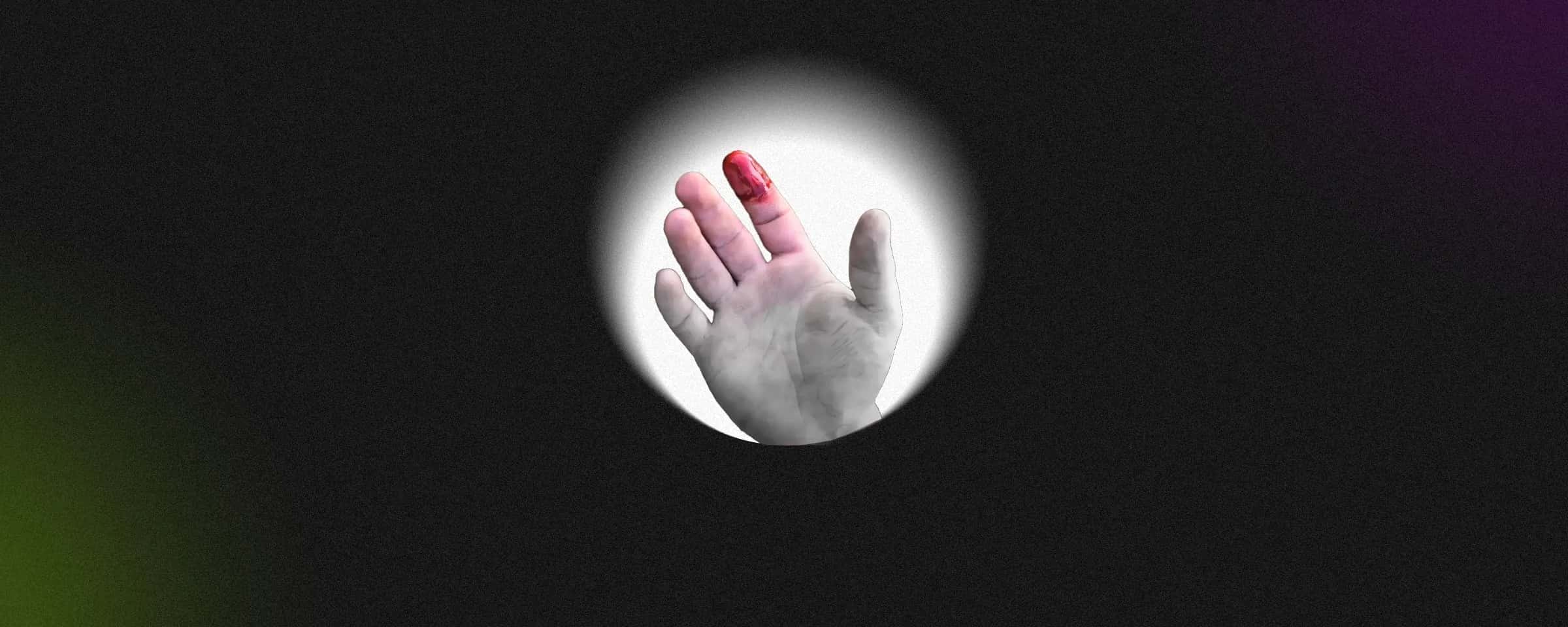 What Is Haemophilia? Is There a New Cure for It?