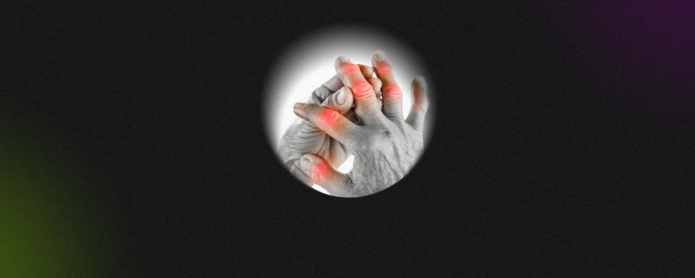 The Dangers of Untreated Rheumatoid Arthritis