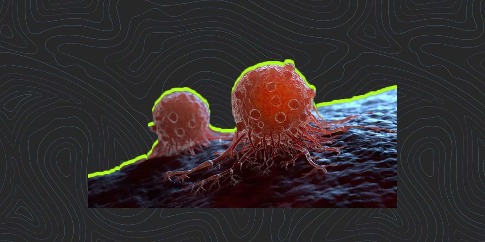 Types of Cancer