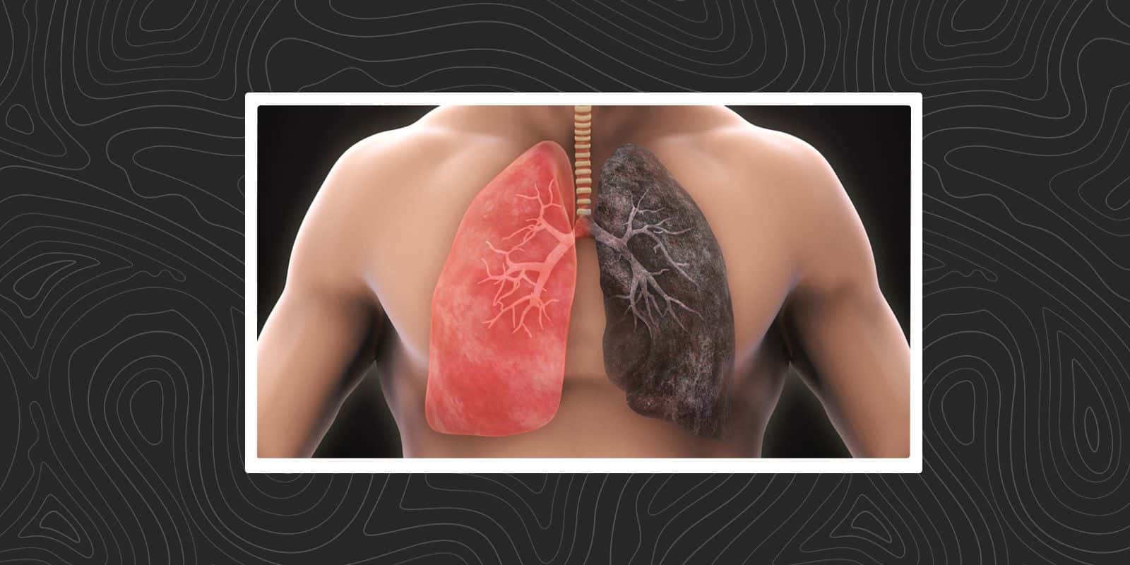 Health Risks of Smoking