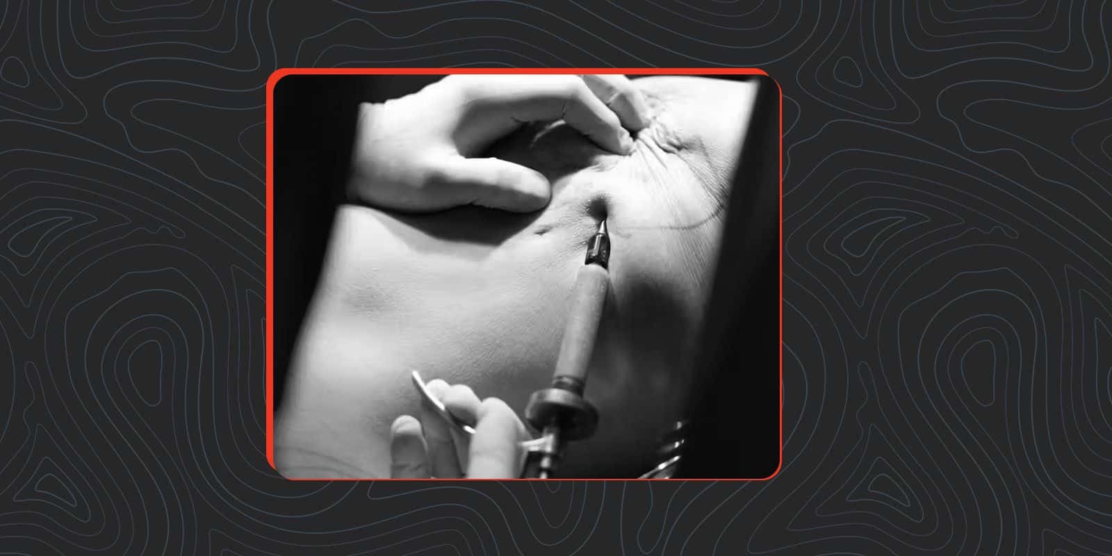 Decoding Stage 2: When Treatment Becomes More Urgent