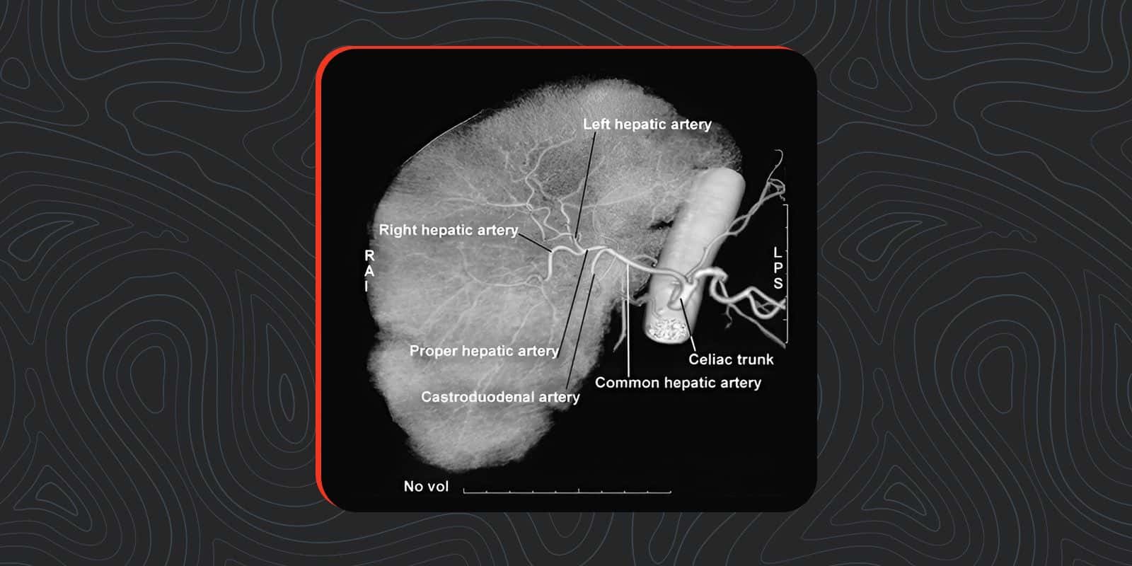 Liver Cancer Diagnosis