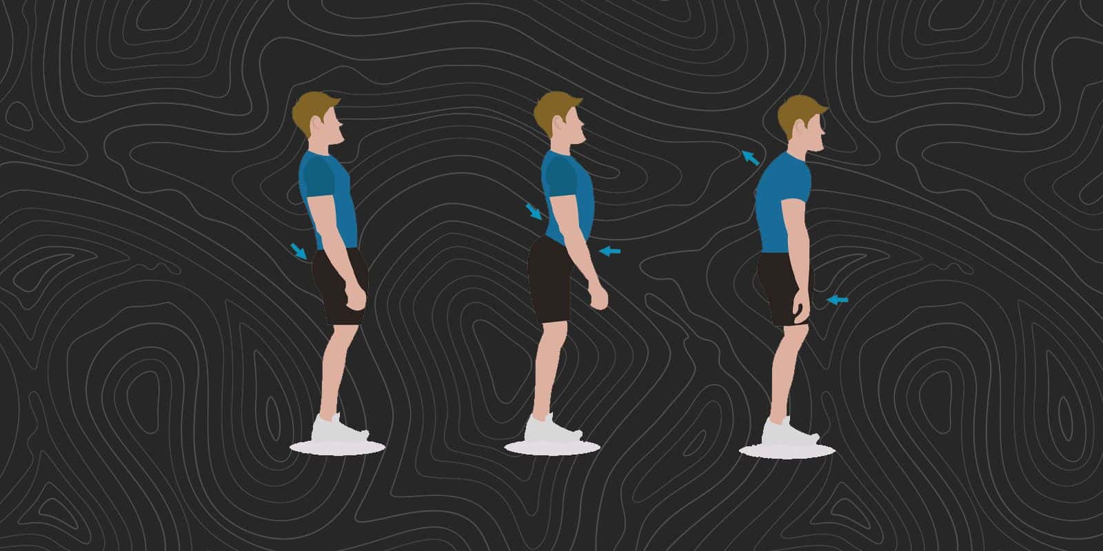 Postural Issues