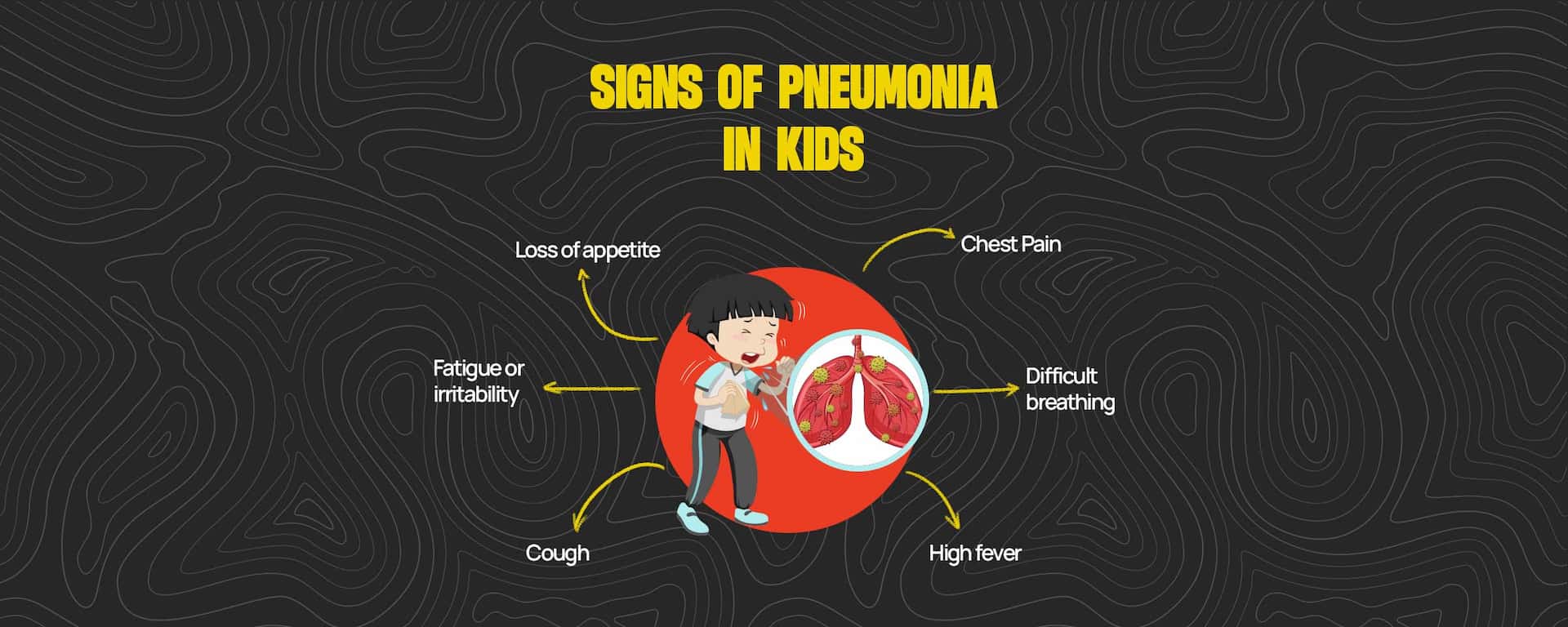 Things you didn't know about Pneumonia