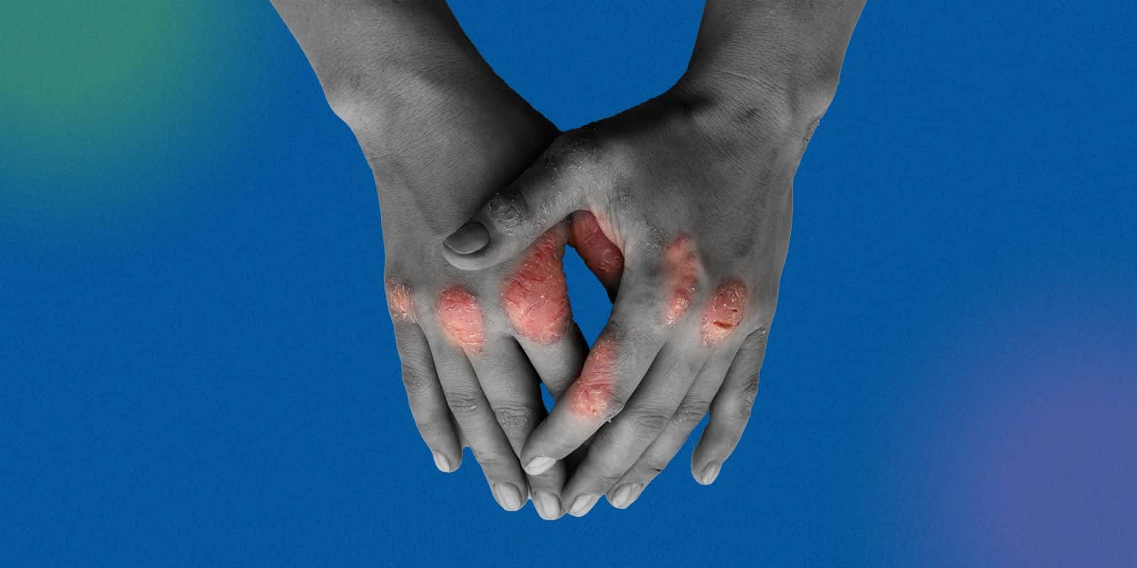 The "Skin"-dlers Disease List 