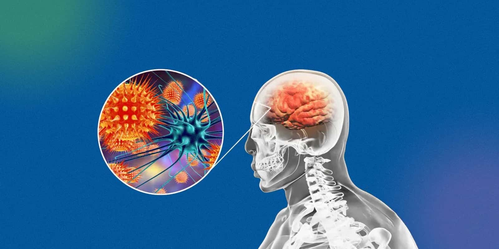 Symptoms of H5N1 in humans