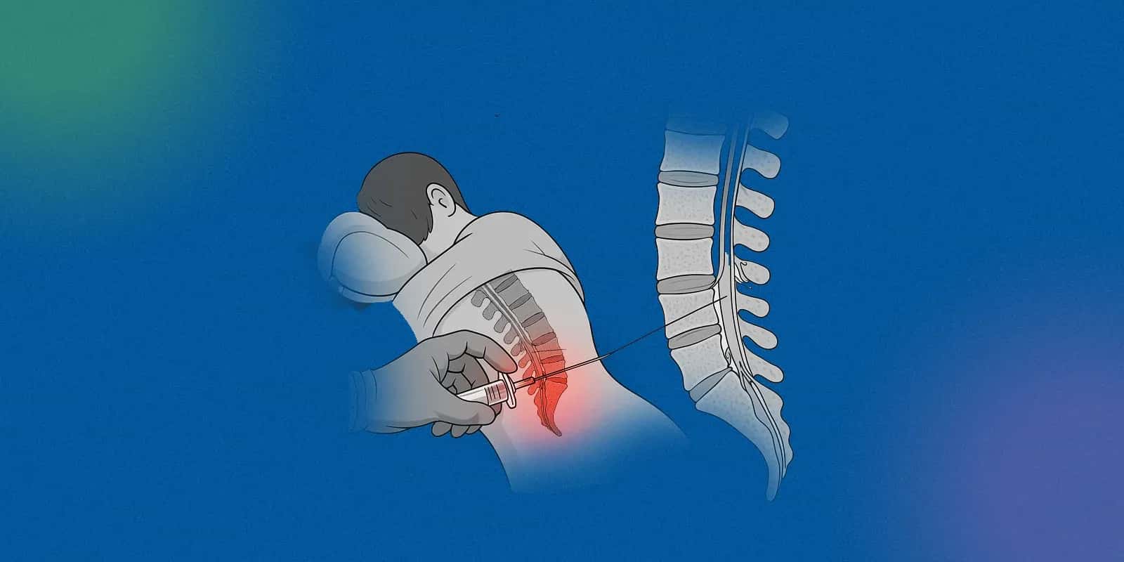 Diagnosis and Treatment
