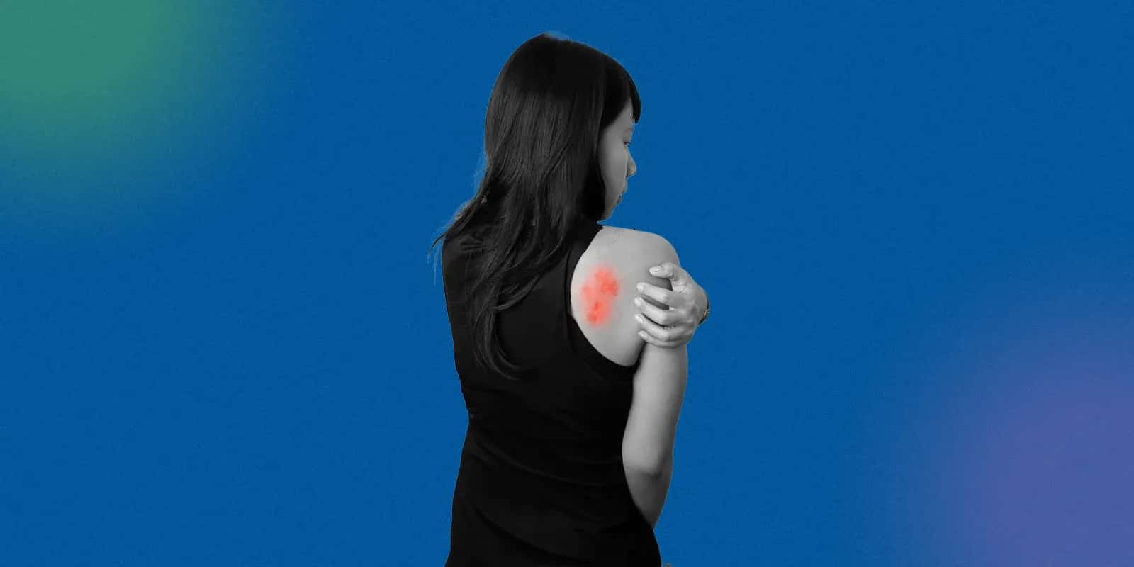 Anxiety Rash Treatments