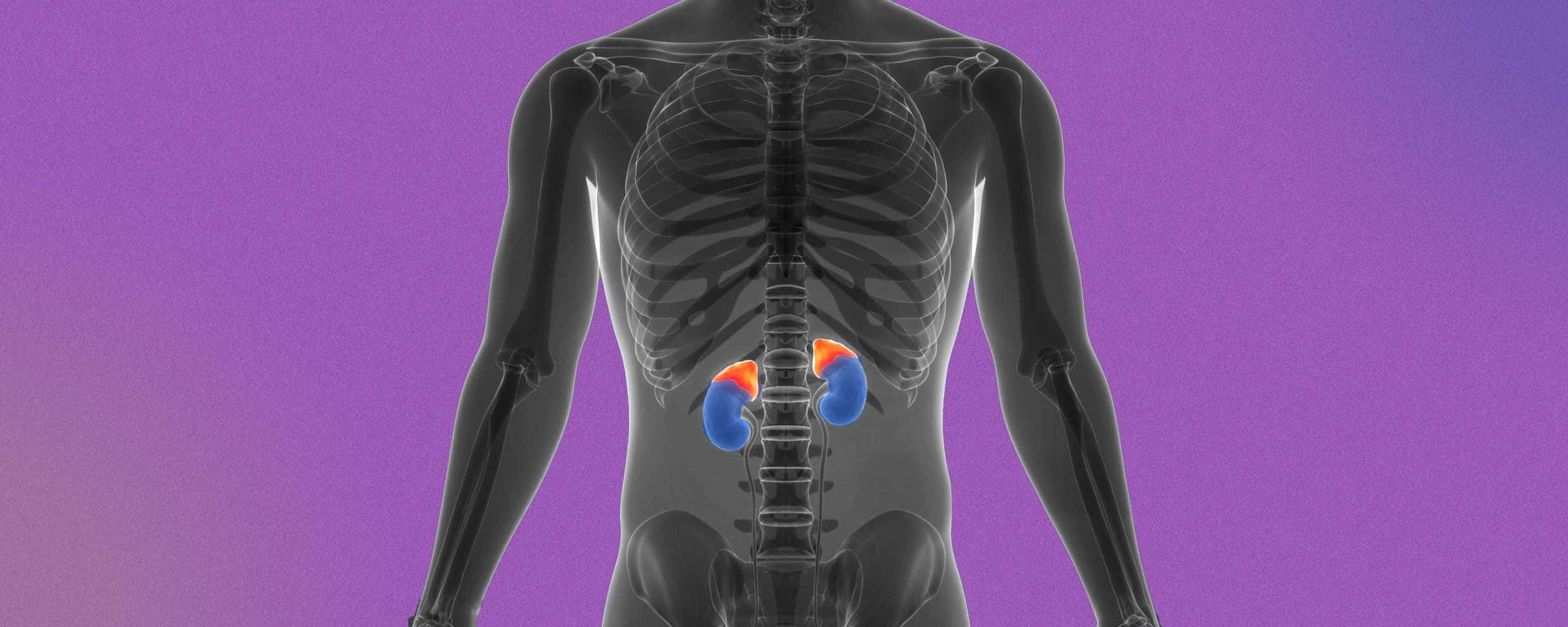 Adrenocortical Carcinoma- Cancer of the Adrenal Glands