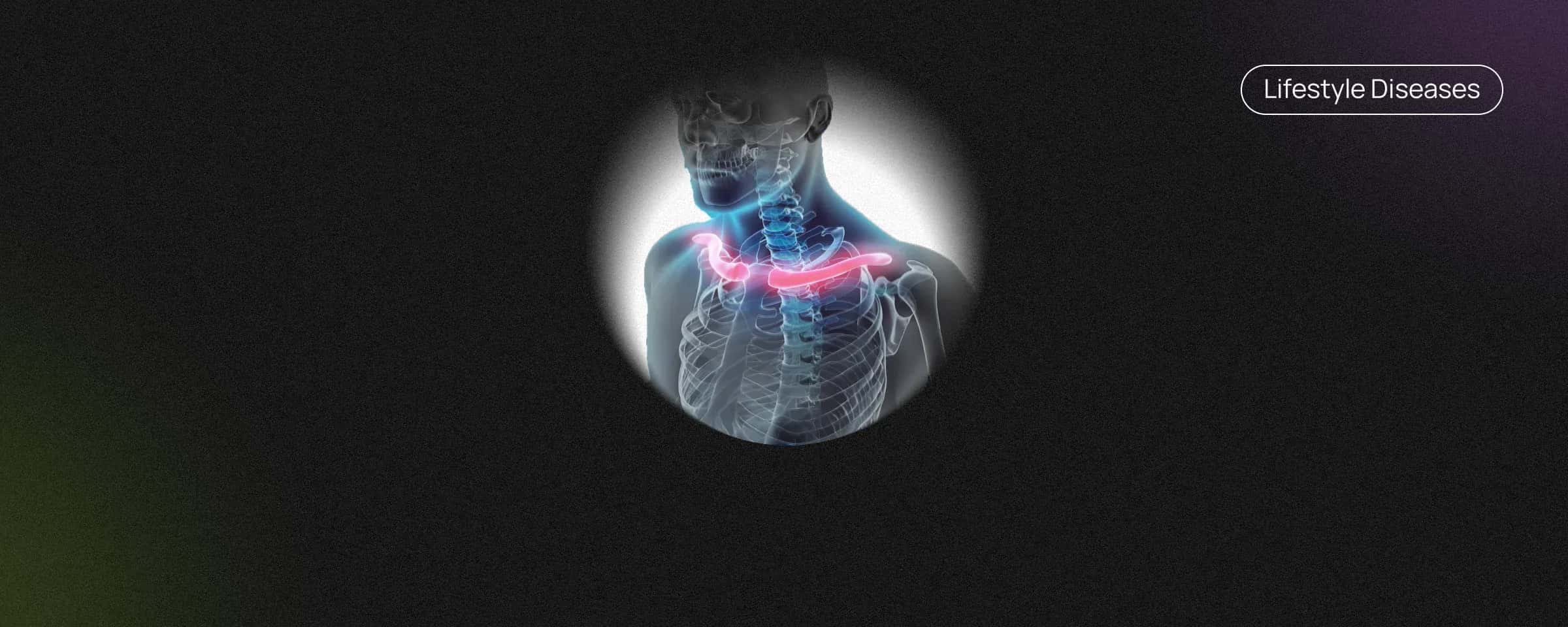 Bone Cancer - Causes, Symptoms and Treatment 