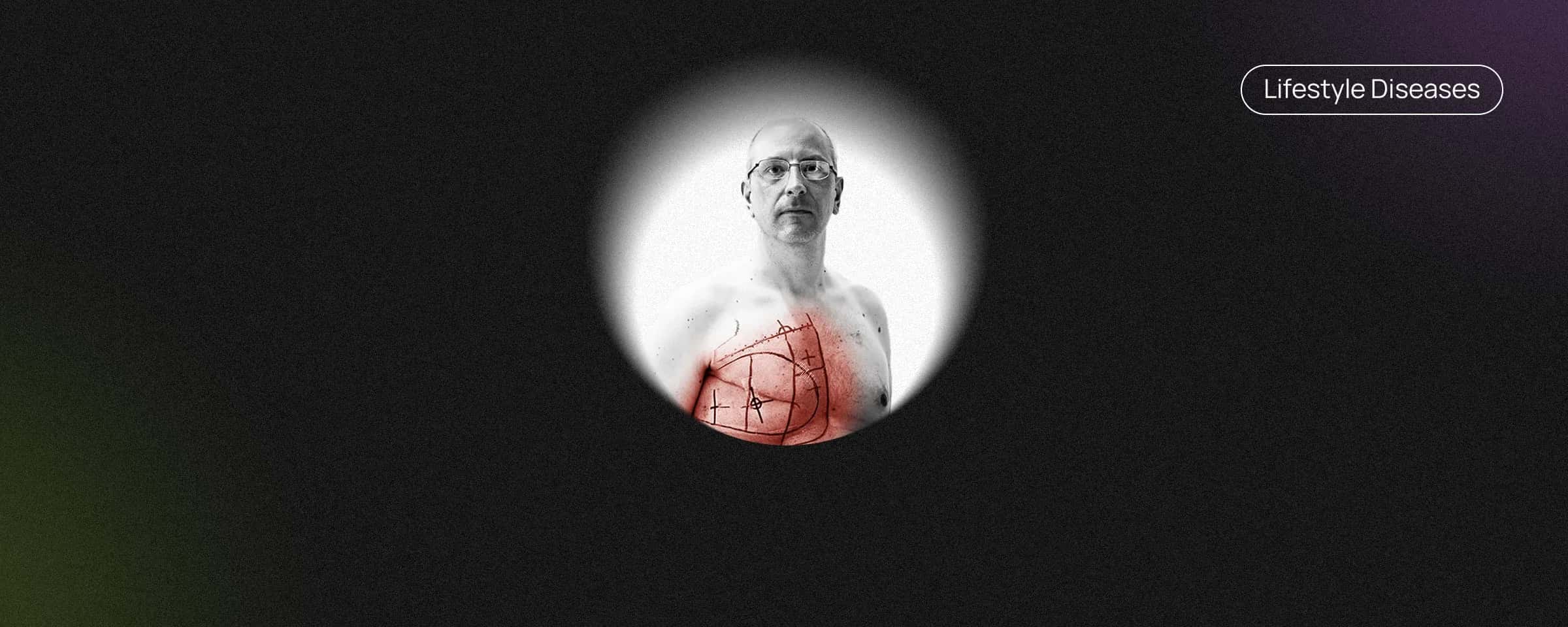 The Detailed Guide To Male Breast Cancer