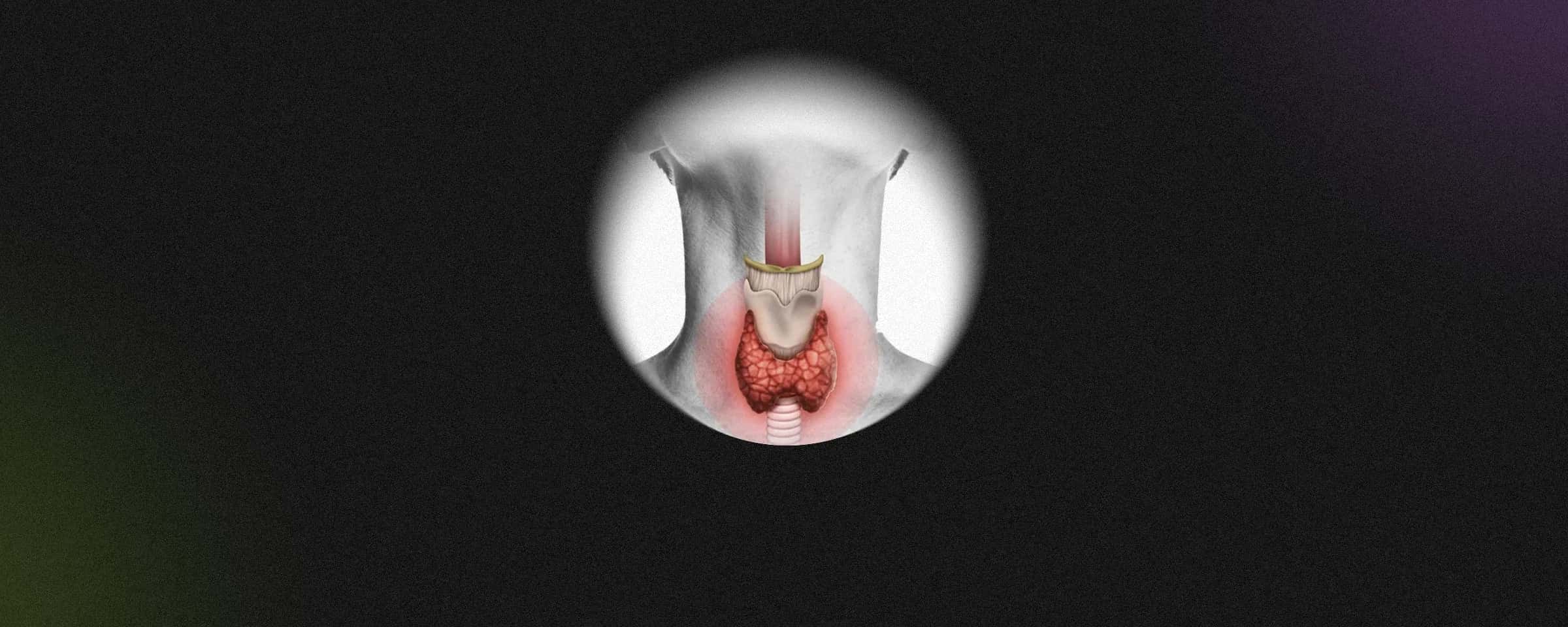 10 Signs of Hypothyroidism That You Should Be Worried Of