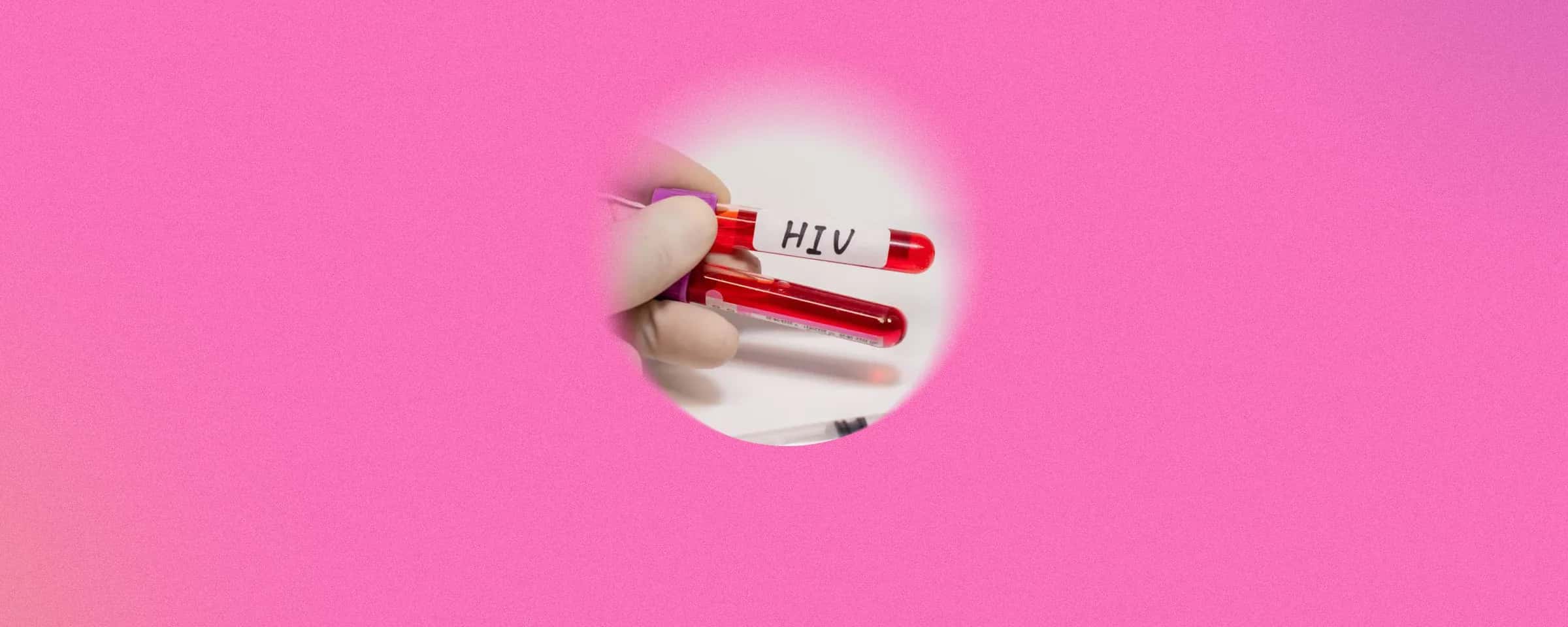 What To Know About HIV Wasting Syndrome