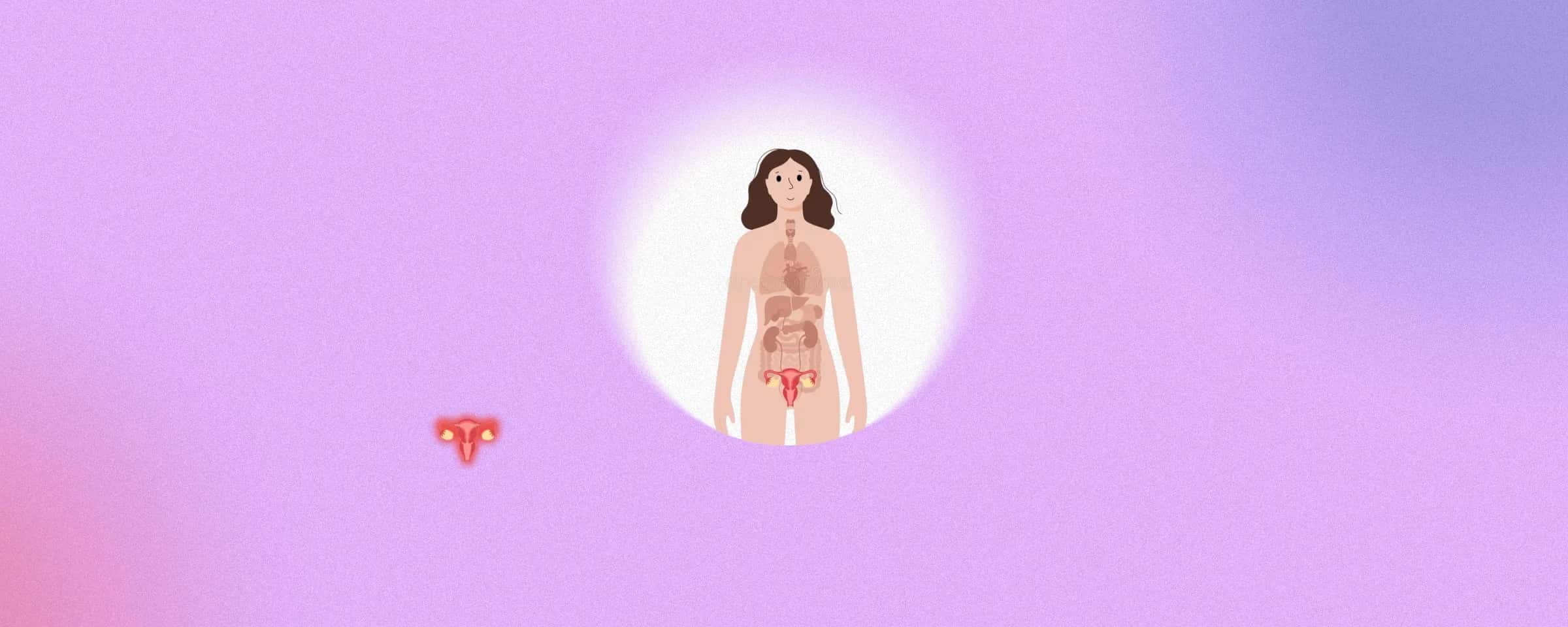 PCOM or Polycystic Ovarian Morphology