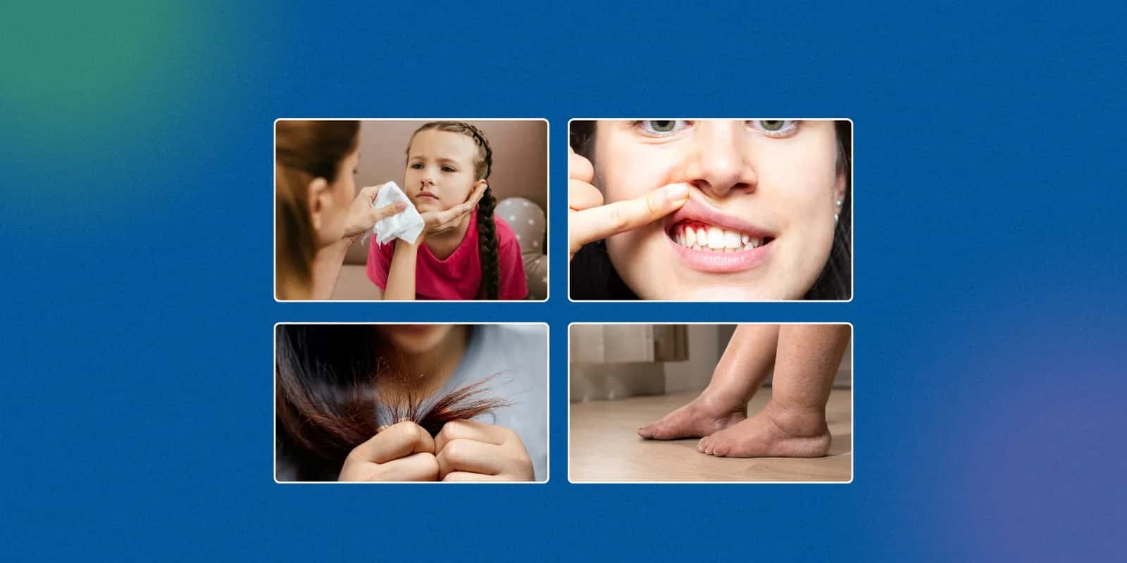 Top 20 Vegetarian and Vegan Foods Rich in Vitamin C