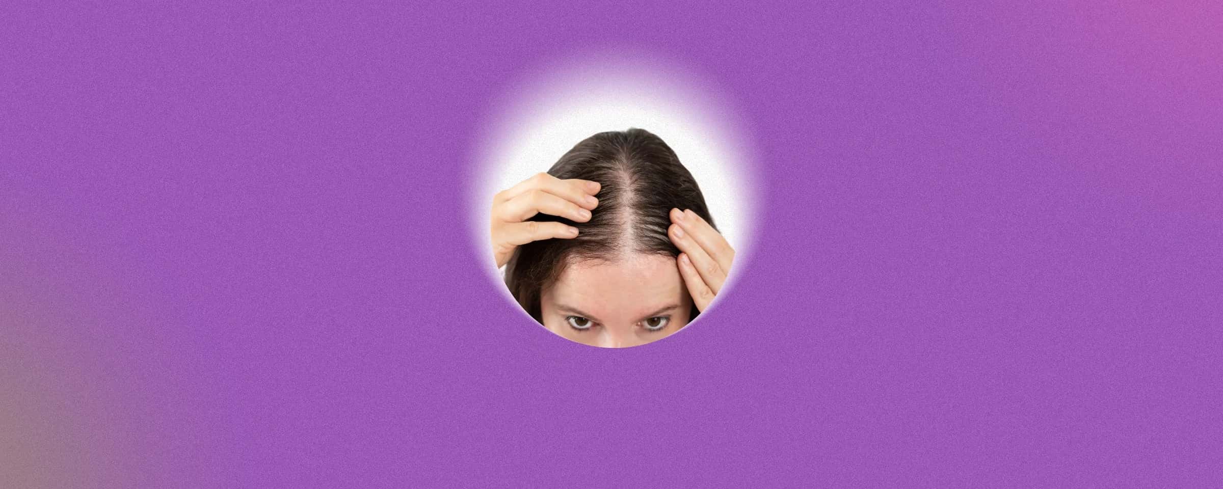 6 Effective Foods That May Block DHT and Help Fight Hair Loss Naturally