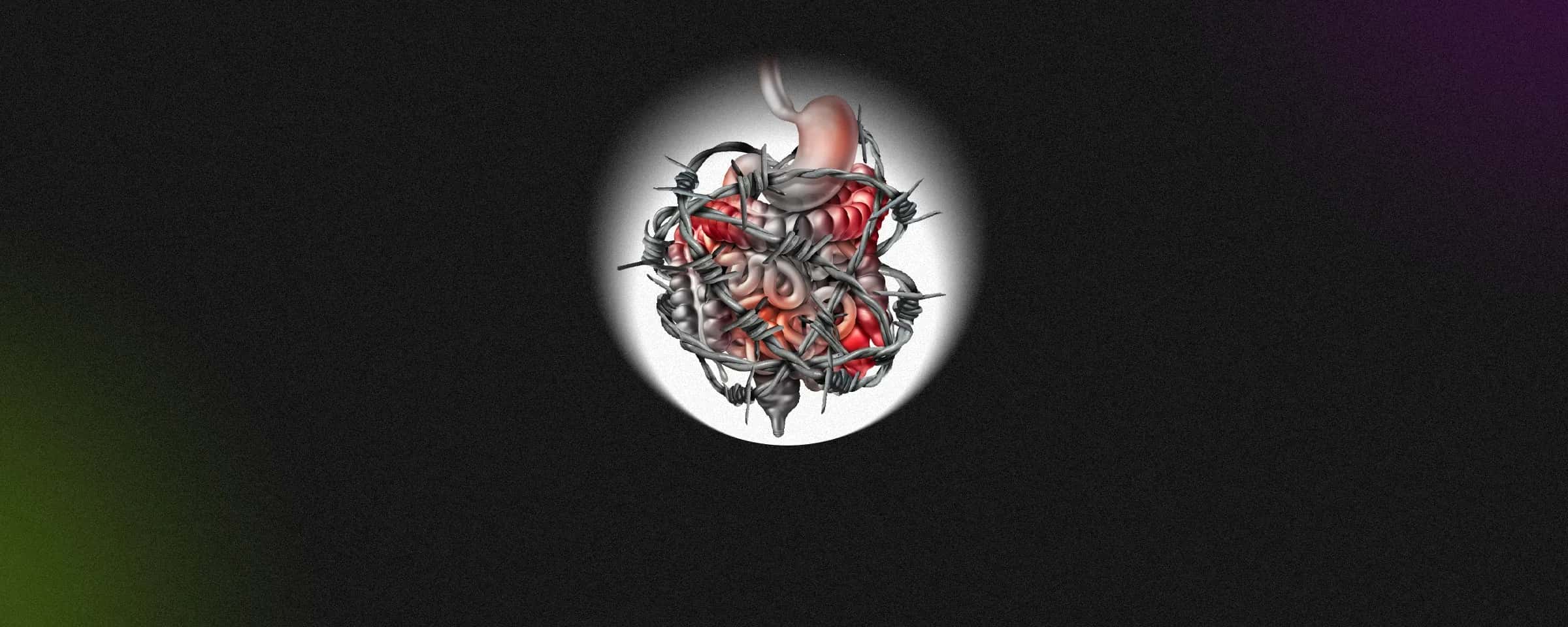 IBS and Diabetes: The Unholy Alliance