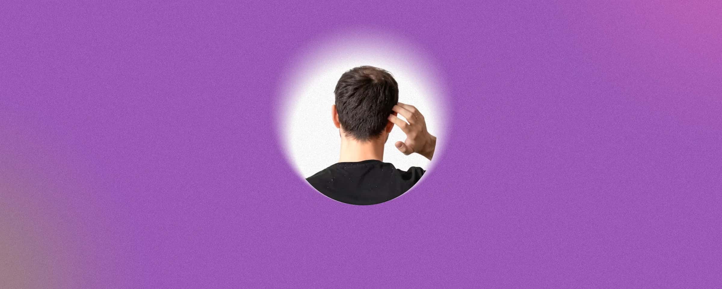 Best Dandruff Hair Shampoo: Causes, Treatments, and Top Anti-Dandruff Options