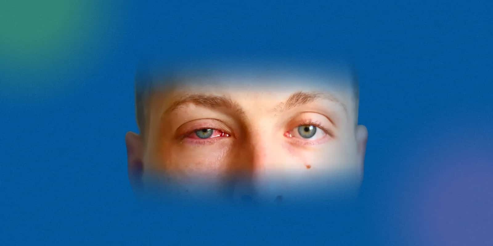 Uses of Chloramphenicol Eye Drops and Ointments: Indications and Benefits