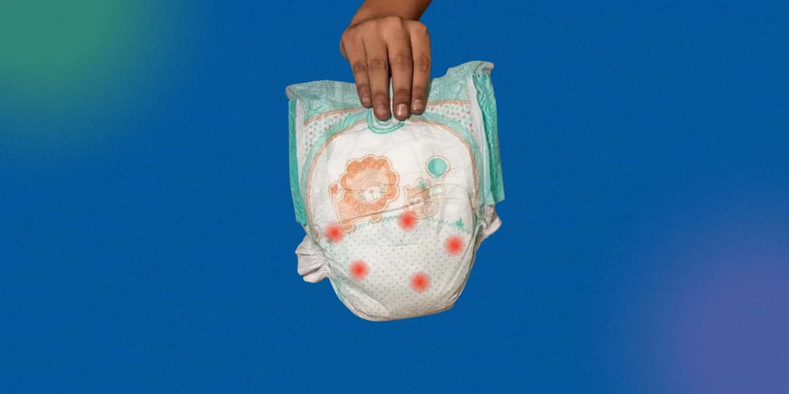 Best Creams for Diaper Rash: Choosing the Right Napkin Rash Cream for Newborns and Infants