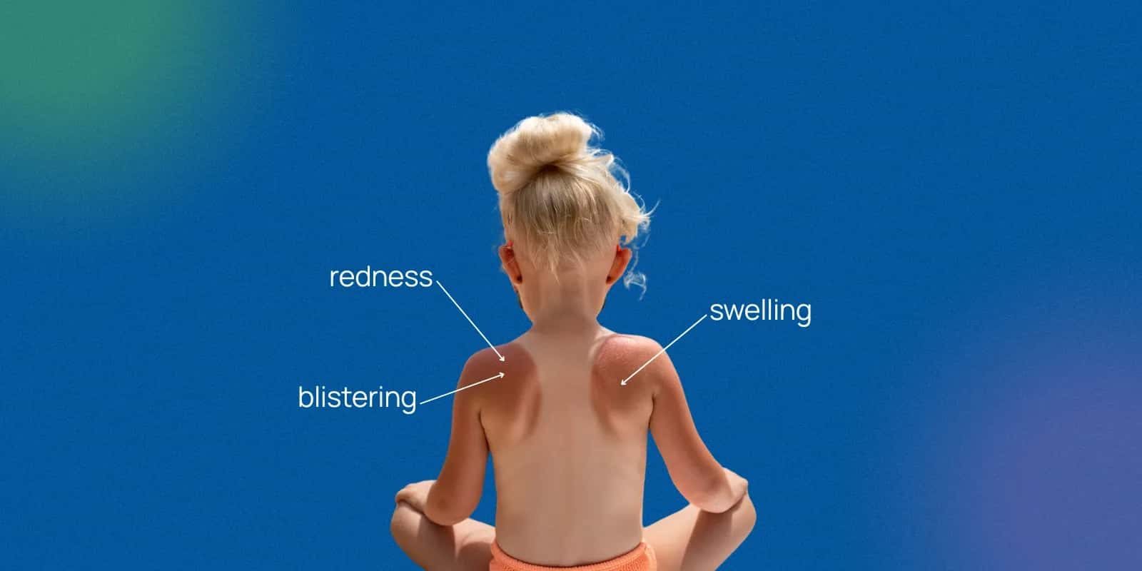 Choosing the Best Sunscreen for Kids: What Parents Should Know