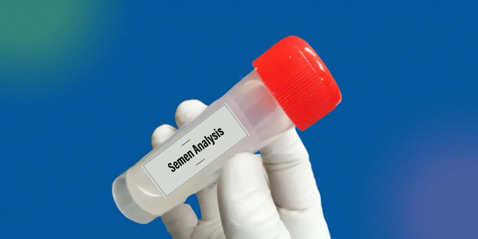 What is a Normal Sperm Analysis Report? Key Parameters Explained