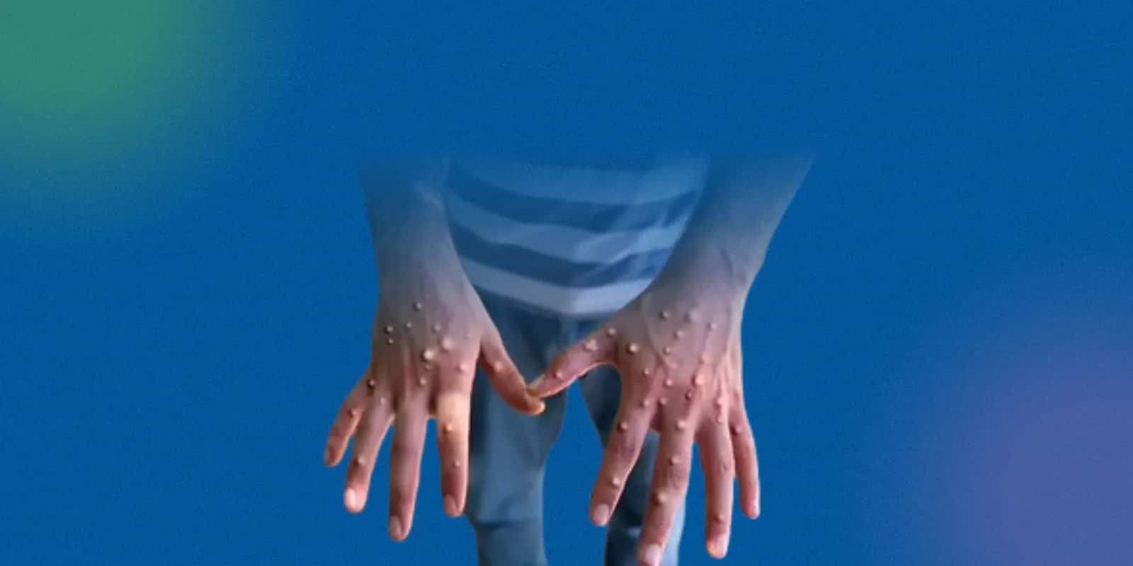 Kerala Case: Health Officials Suggest Staying Vigilant