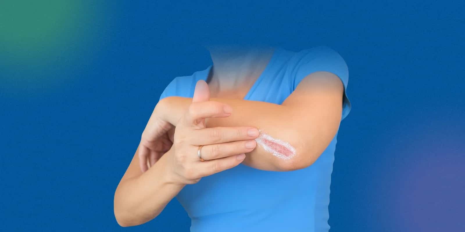 Keloid Injections for Scar Reduction