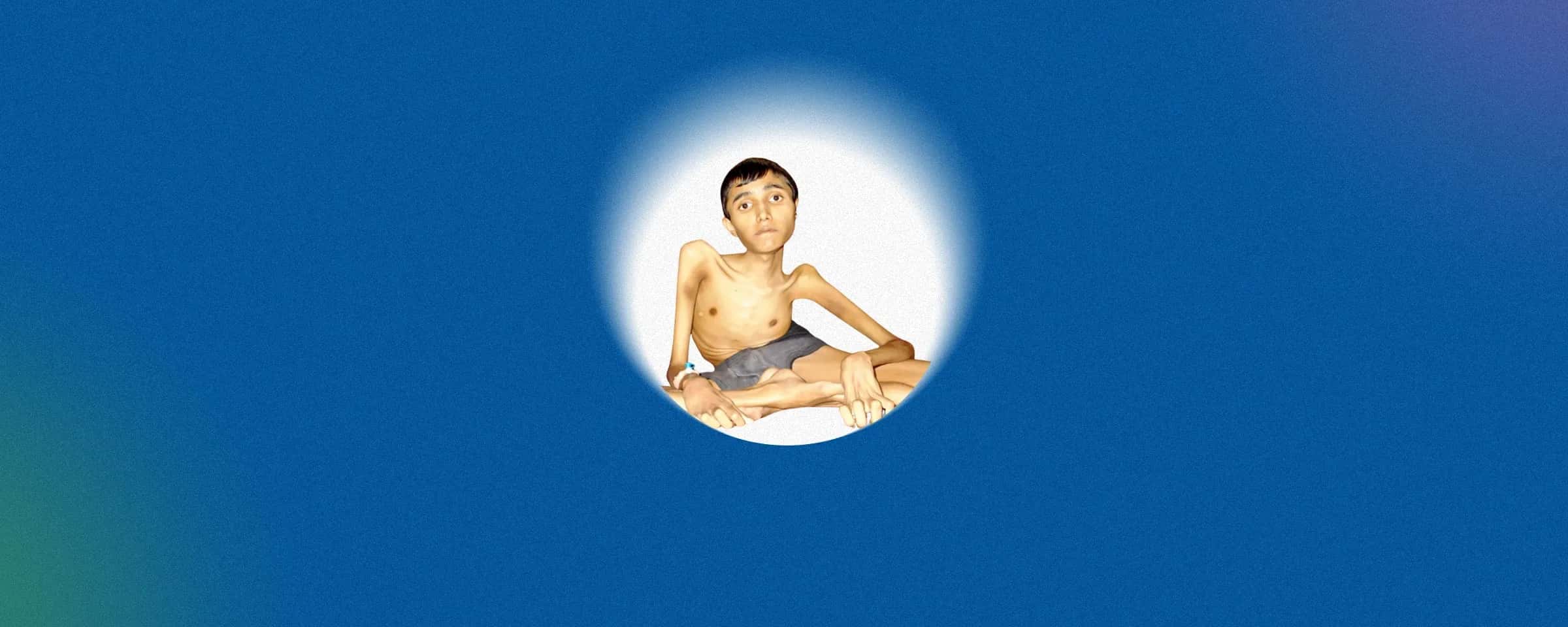 Muscular Dystrophy: Understanding Muscle Weakness and Health Deterioration