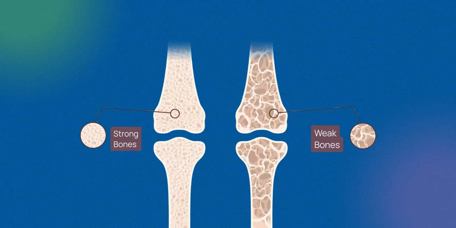 Why Calcium and Vitamin D3 Are Essential for Bone Health