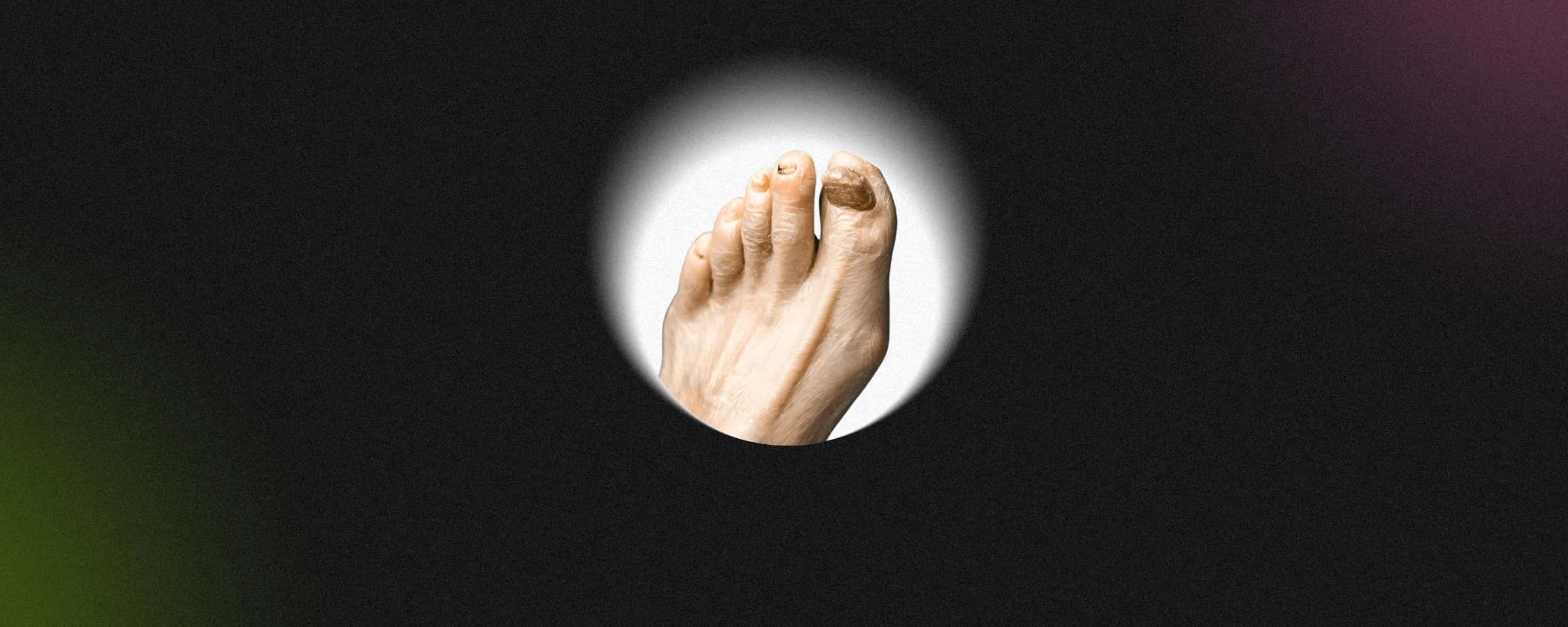 Terbinafine Tablets: What They Are and How They Work