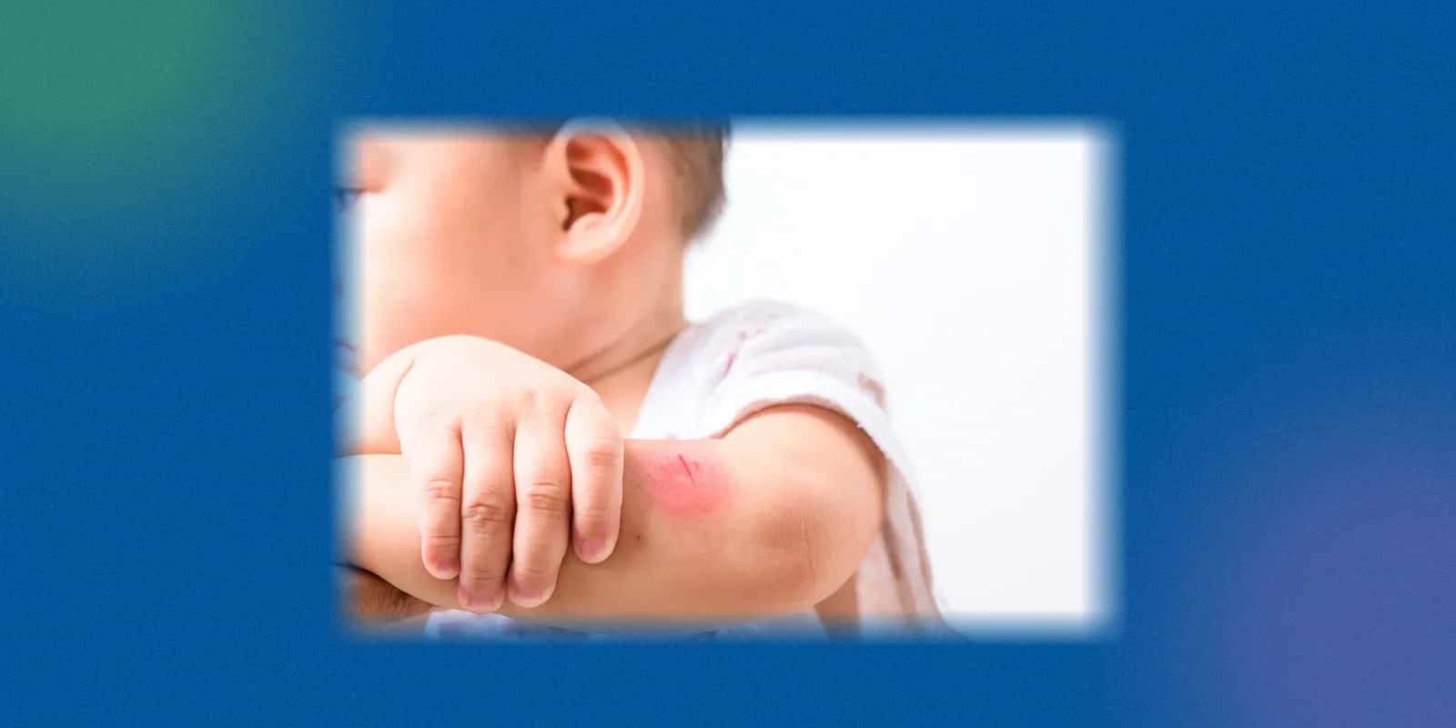 Emergency Tetanus Injection: Validity and Need in India
