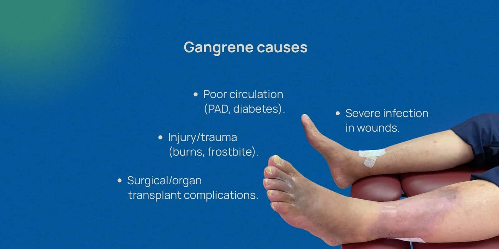 Gangrene of Toes: Causes, Symptoms, and Treatment