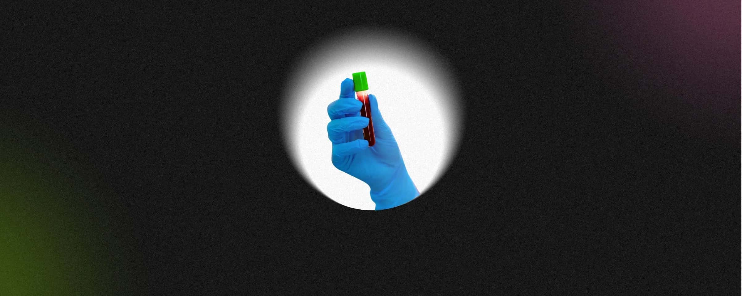 Understanding Your MPV Test Results: What Your Blood Report MPV Means