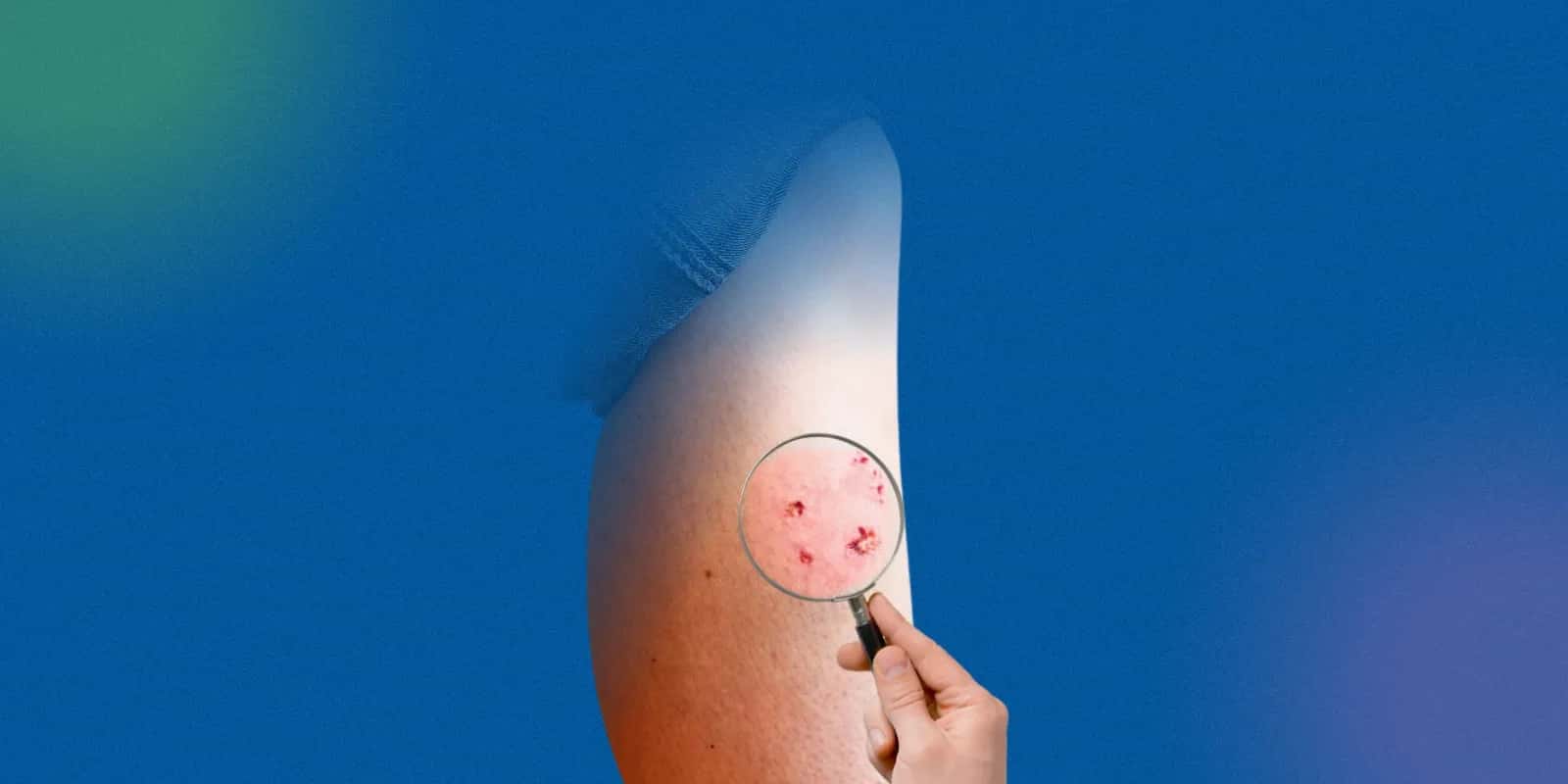 Protecting Yourself from Rabies After a Dog Bite